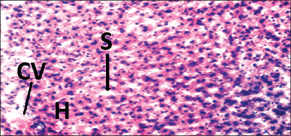 Photomicrograph of liver of rat of experimental Group 2, which received 100 mg/kg bodyweight of lead acetate only. Hematoxylin and Eosin × 100. H = Hepatocytes, S = Blood sinusoids and CV = Central Vein. Histopathological evaluations showed normal histoarchitecture of the liver components