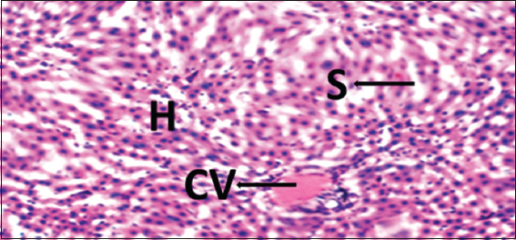 Photomicrograph of liver of rat of experimental Group 4, which received 100 mg/kg bodyweight lead acetate (2 weeks) + 15 mg/kg bodyweight Morinda lucida (3 weeks) respectively. Hematoxylin and Eosin × 100. H = Hepatocytes, S = Blood sinusoids and CV = Central Vein. Histopathological evaluations showed normal histoarchitecture of the liver components
