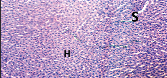 Photomicrograph of liver of rat of experimental Group 6, which received 100 mg/kg bodyweight lead acetate (2 weeks) + 10 mg/kg bodyweight Annona muricata (3 weeks), respectively. Hematoxylin and Eosin × 100. H = Hepatocytes, S = Blood sinusoids and CV = Central Vein. Histopathological evaluations showed normal histoarchitecture of the liver components