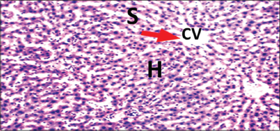 Photomicrograph of liver of rat of experimental Group 8, which received only 15 mg/kg bodyweight Morinda lucida (3 weeks), respectively. Hematoxylin and Eosin × 100. H = Hepatocytes, S = Blood sinusoids and CV = Central Vein. Histopathological evaluations showed normal histoarchitecture of the liver components