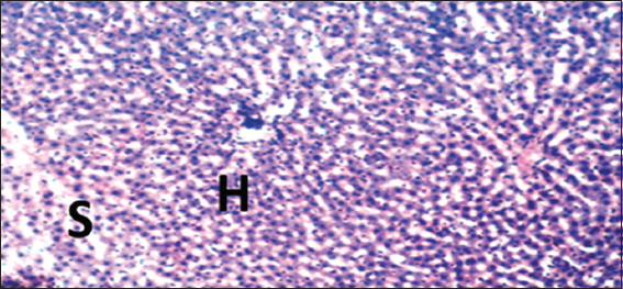 Photomicrograph of liver of rat of experimental Group 10, which received only 10 mg/kg bodyweight Annona muricata (3 weeks), respectively. Hematoxylin and Eosin × 100. H = Hepatocytes, S = Blood sinusoids and CV = Central Vein. Histopathological evaluations showed normal histoarchitecture of the liver components