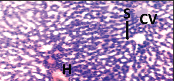 Photomicrograph of liver of rat of experimental Group 11, which received co-administration of 100 mg/kg bodyweight lead acetate + 15 mg/kg bodyweight Morinda lucida (5 weeks). Hematoxylin and Eosin × 100. H = Hepatocytes, S = Blood sinusoids and CV = Central Vein. Histopathological evaluations showed normal histoarchitecture of the liver components