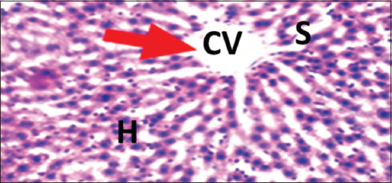 Photomicrograph of liver of rat of experimental Group 12, which received co-administration of 100 mg/kg bodyweight lead acetate + 10 mg/kg bodyweight Annona muricata (5 weeks). Hematoxylin and Eosin × 100. H = Hepatocytes, S = Blood sinusoids and CV = Central Vein. Histopathological evaluations showed normal histoarchitecture of the liver components