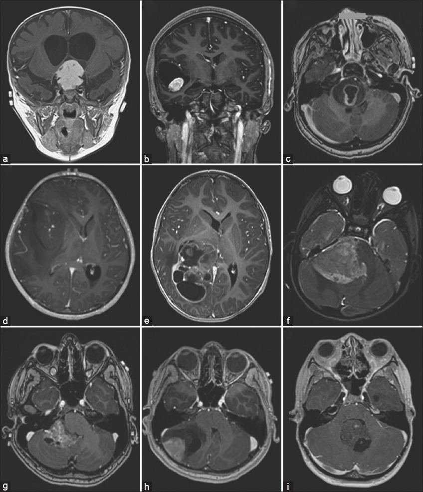 (a-i) The figure requires the results of the assessment. In the figure, we show an example panel from part 1 of the assessment. The lower left image is an enhanced image and all other images are degraded. The experts must indicate which (if any) is useful