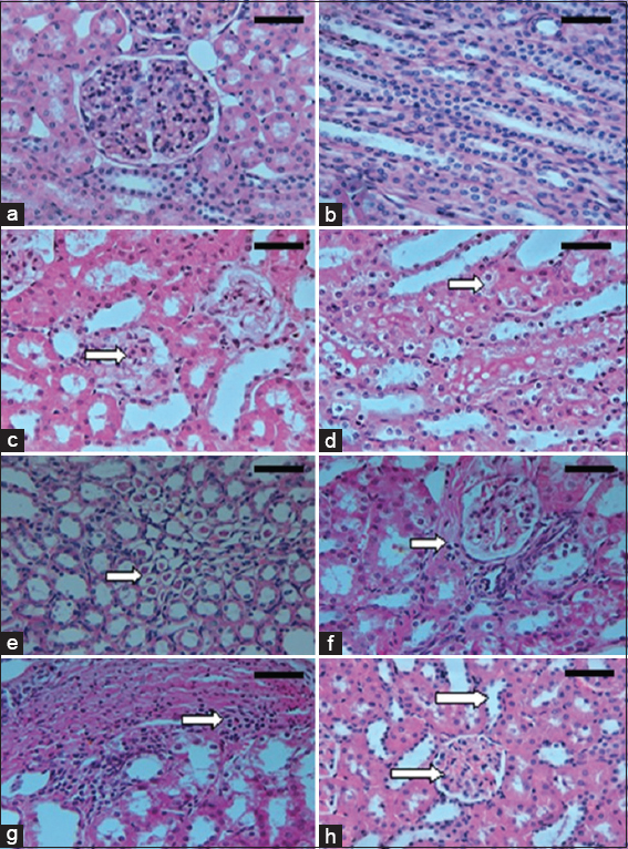 (a-h) Microscopic appearances from kidney tissues of the experimental rats (H&E, ×400). Control group rat shows normal renal architecture with normal glomeruli and tubules of both cortex (a) and medulla (b). Dinitrophenol (DNP) hypoxic group demonstrates mild patchy expansion of mesangial matrix, with glomerular basement membrane (GBM) diffuse thickening (c), tubular epithelium shows vacuolated cytoplasm (cloudy swelling and hydropic degeneration) in renal cortex (d) and medulla with marked intratubular hyaline cast (e), interstitial fibrosis and mononuclear leukocytic infiltrates (f and g). DNP + Nigella sativa treated group shows decreased glomerular size, mesangial matrix, GBM thickness, tubular dilatation and casts formation (h). Scale bars 100 μm in (a-d) and 50 μm in (e-h)